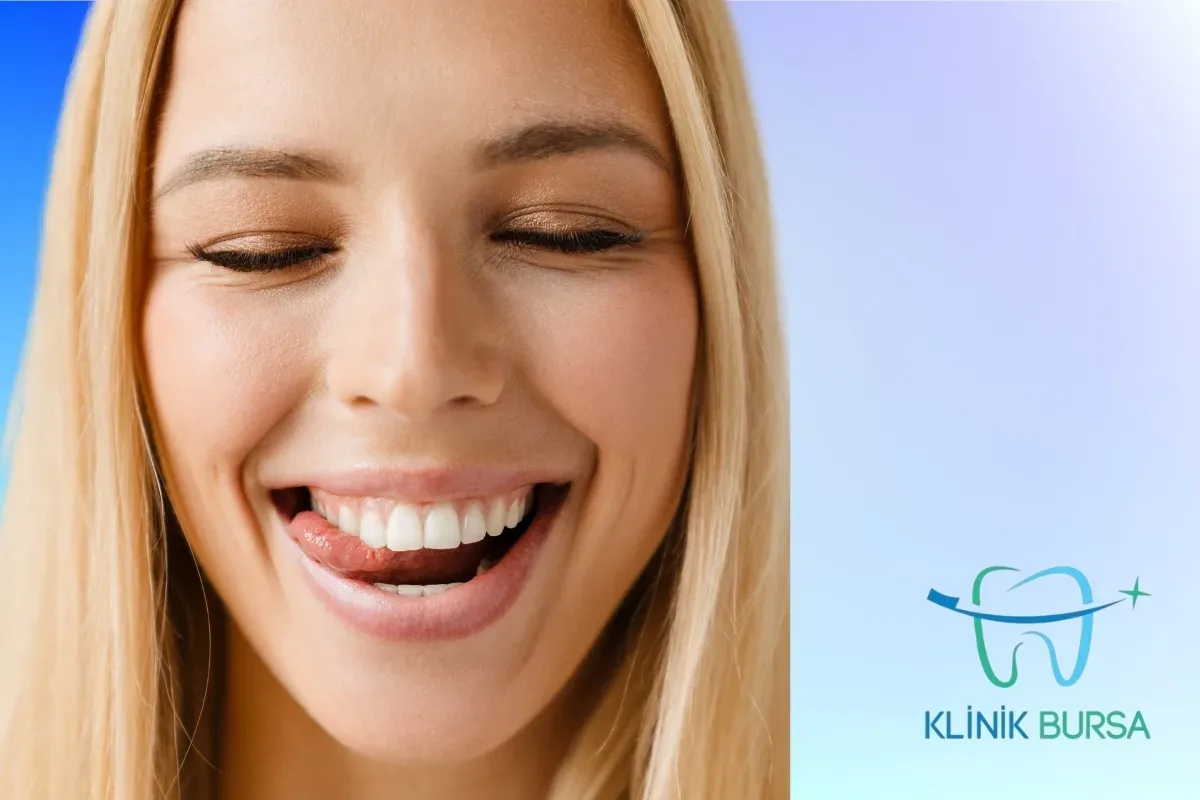 Kompozit Lamine Klinik Bursa